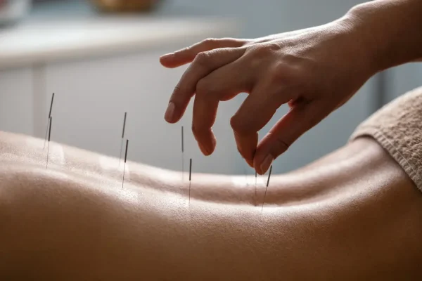 acupuncture clinic